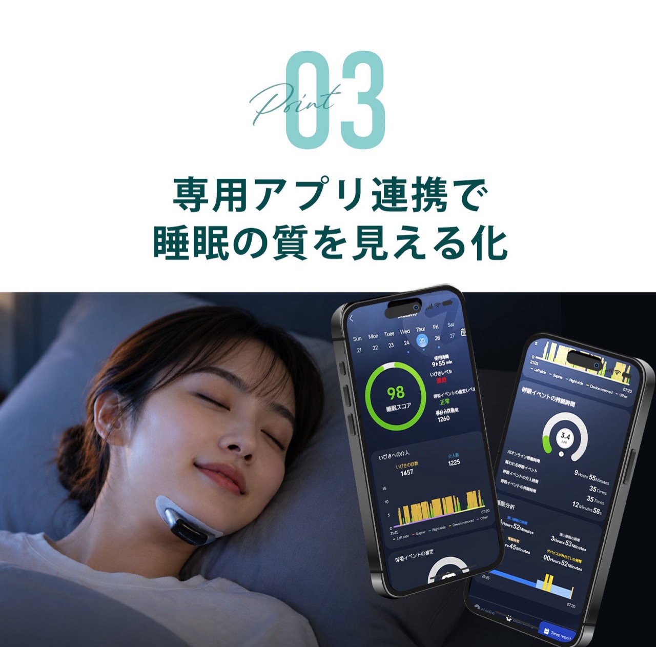 SleepXが掲げる睡眠医療・AI/データテクノロジー・睡眠改善サービスを融合した睡眠DXソリューションのビジョン画像