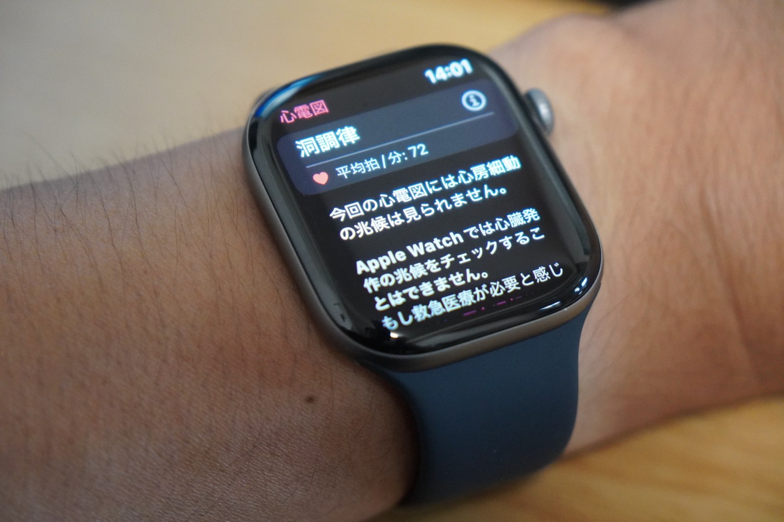 腕に着けたApple Watch Series 12の心電図アプリの結果。洞調律、平均心拍数72拍/分