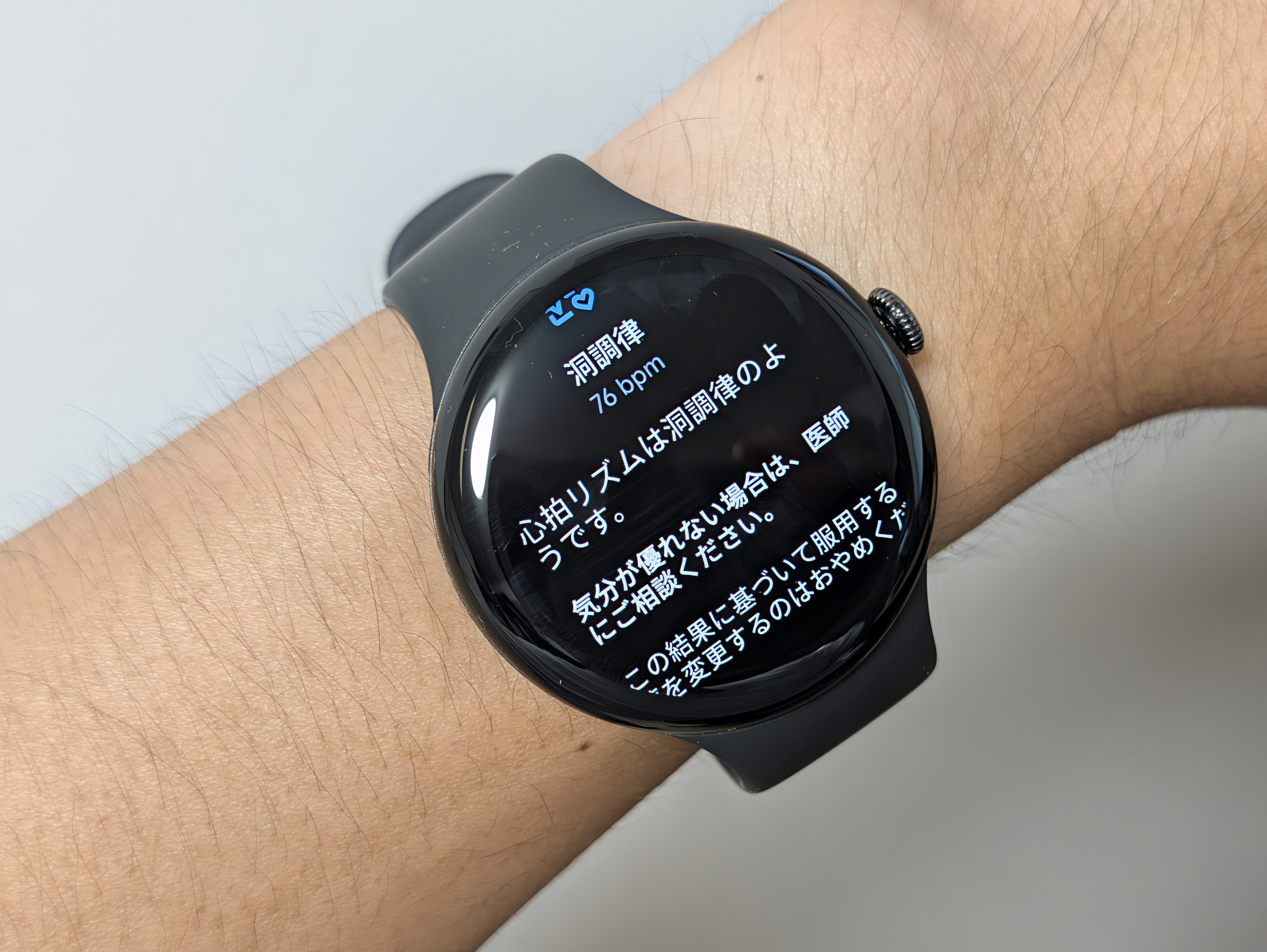 Pixel Watch 5 で心電図を測った直後の画面。洞調律と76bpmが表示され、気分が優れない場合は医師にご相談くださいという注意が続いている