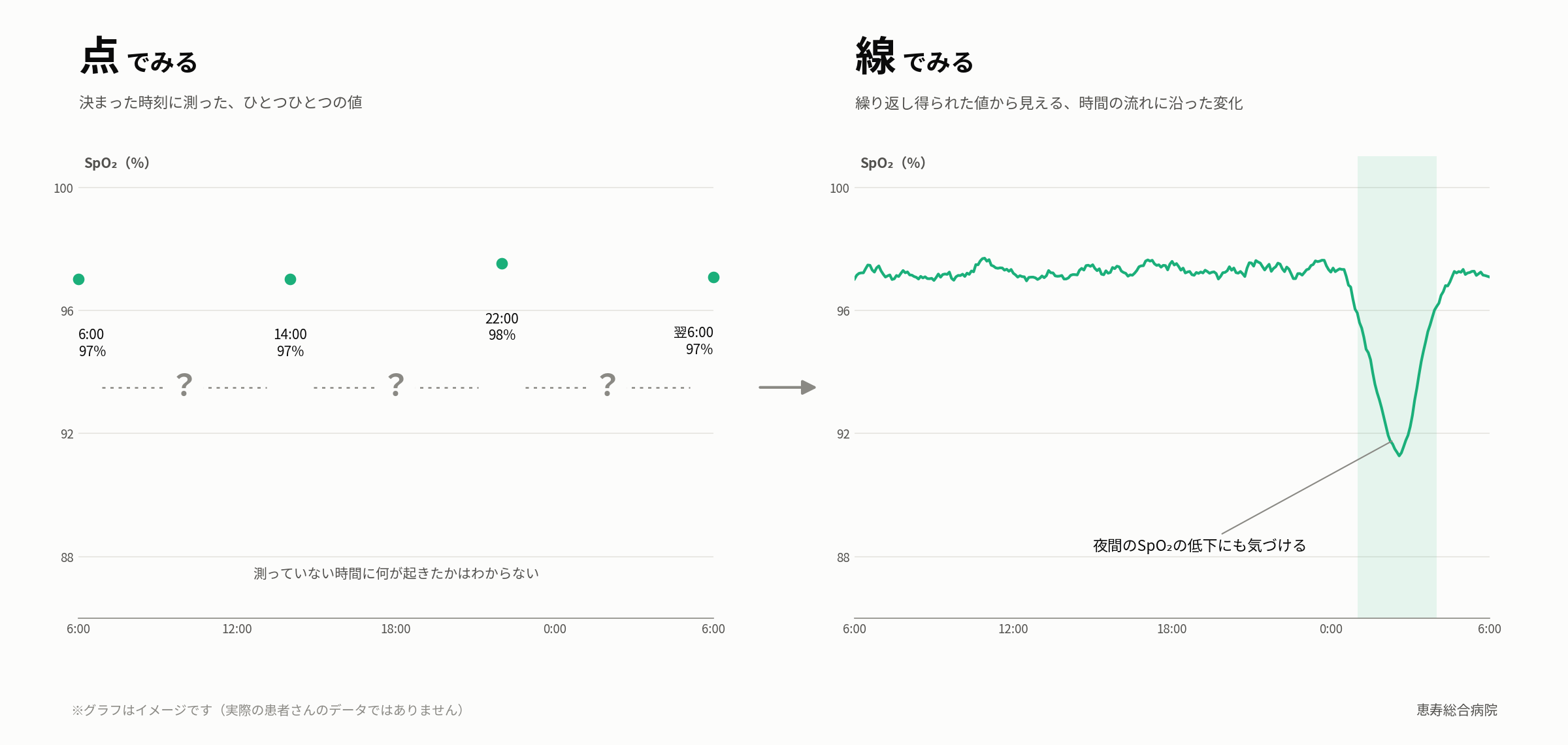 1日4回の測定値だけを示す「点でみる」グラフと、SpO2を連続で記録し夜間の低下に気づける「線でみる」グラフを並べたイメージ図